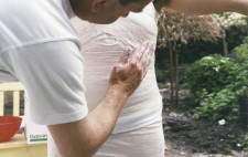 Close-up. In a garden setting, Isolte sits with her arms stretched wide, the technician building layers a corset with strips of wet bandage, coated in plaster of paris, and smoothed into place.